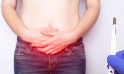 gastroenterologo mexicali especialista en cirugia de hernia